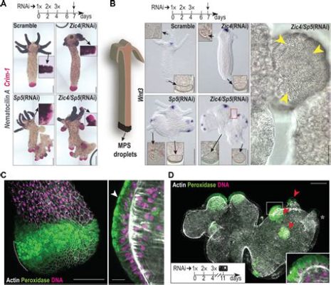  Heteronema! A Microscopic World Wanderer With Tentacles That Twist and Turn