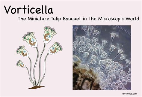 Voticella!  A Tiny Tornado in Disguise, Swirling Gracefully Through the Microscopic World