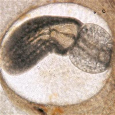  Xiphidiocercaria: A Tiny Trematode That Dreams of Becoming a Fish!